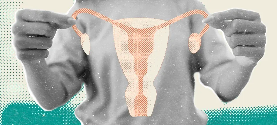 Could Your Symptoms Be PMOS? Understanding the Condition Formerly Called PCOS